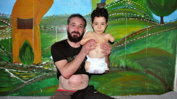 Doğuştan engelli Suriyeli Mustafa  protez istiyor