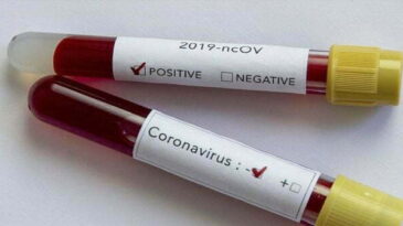 Koronavirüs sindirim yoluyla bulaşmıyor